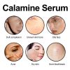 Hoygi Calamine Serum, Skin Dry Dull Acne Muscle Acne Hydrating Plump