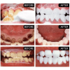 Purple Teeth Whitening Powder Remove Plaque Stains Cleaning Oral Hygiene Bleaching Dental Tools Fresh Breath Brighten Tooth Care